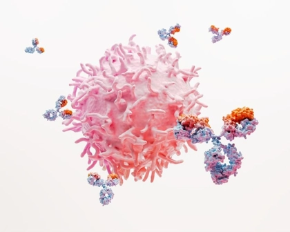 Lupus